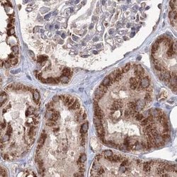 Invitrogen PEX13 Polyclonal Antibody 100 &mu;L; Unconjugated:Antibodies,