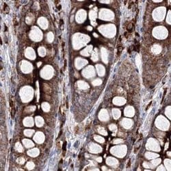 Invitrogen PEX13 Polyclonal Antibody 100 &mu;L; Unconjugated:Antibodies,
