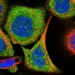 Invitrogen ABHD13 Polyclonal Antibody 100 &mu;L; Unconjugated:Antibodies,