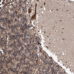Invitrogen ABHD13 Polyclonal Antibody 100 &mu;L; Unconjugated:Antibodies,