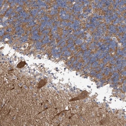 Invitrogen ABHD13 Polyclonal Antibody 100 &mu;L; Unconjugated:Antibodies,