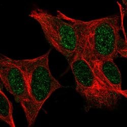 Invitrogen FOXR2 Polyclonal Antibody 100 &mu;L; Unconjugated:Antibodies,
