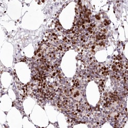 Invitrogen LDB1 Polyclonal Antibody 100 &mu;L; Unconjugated:Antibodies,