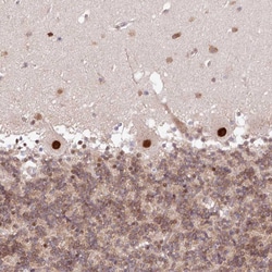 Invitrogen LDB1 Polyclonal Antibody 100 &mu;L; Unconjugated:Antibodies,