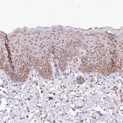 Invitrogen LDB1 Polyclonal Antibody 100 &mu;L; Unconjugated:Antibodies,