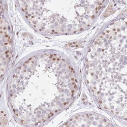 Invitrogen LDB1 Polyclonal Antibody 100 &mu;L; Unconjugated:Antibodies,