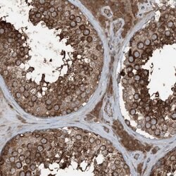 Invitrogen RAB3GAP1 Polyclonal Antibody 100 &mu;L; Unconjugated:Antibodies,