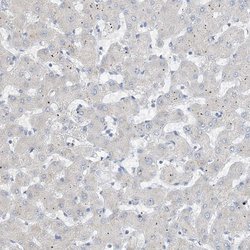 Invitrogen CTRL Polyclonal Antibody 100 &mu;L | Buy Online | Invitrogen&trade; | Fisher Scientific