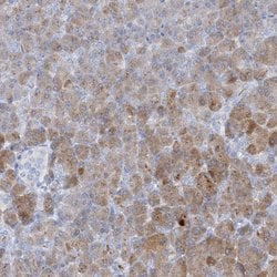 Invitrogen CTRL Polyclonal Antibody 100 &mu;L | Buy Online | Invitrogen&trade; | Fisher Scientific