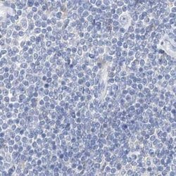 Invitrogen CTRL Polyclonal Antibody 100 &mu;L | Buy Online | Invitrogen&trade; | Fisher Scientific