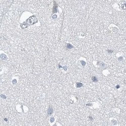 Invitrogen CTRL Polyclonal Antibody 100 &mu;L | Buy Online | Invitrogen&trade; | Fisher Scientific