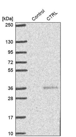 Invitrogen CTRL Polyclonal Antibody 100 &mu;L | Buy Online | Invitrogen&trade; | Fisher Scientific