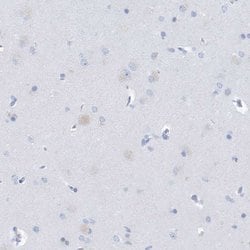 Invitrogen PTPRO Polyclonal Antibody 100 &mu;L; Unconjugated:Antibodies,