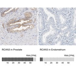 Invitrogen RCAN3 Polyclonal Antibody 100 &mu;L; Unconjugated:Antibodies,
