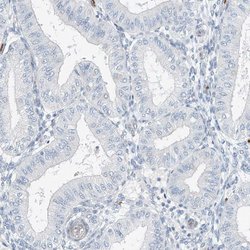 Invitrogen RCAN3 Polyclonal Antibody 100 &mu;L; Unconjugated:Antibodies,