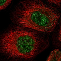 Invitrogen MSL3 Polyclonal Antibody 100 &mu;L | Buy Online | Invitrogen&trade; | Fisher Scientific