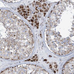 Invitrogen SAMM50 Polyclonal Antibody 100 &mu;L; Unconjugated:Antibodies,