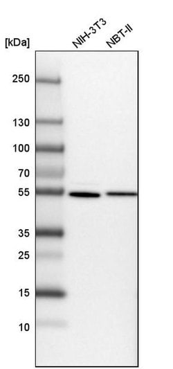 Invitrogen SAMM50 Polyclonal Antibody 100 &mu;L; Unconjugated:Antibodies,