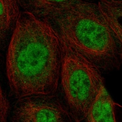 Invitrogen SNRNP27 Polyclonal Antibody 100 &mu;L; Unconjugated:Antibodies,