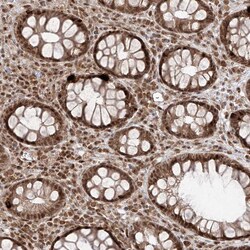 Invitrogen SNRNP27 Polyclonal Antibody 100 &mu;L; Unconjugated:Antibodies,