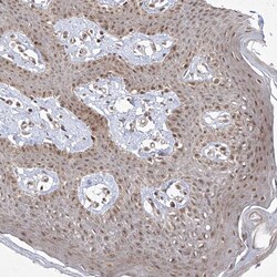 Invitrogen SNRNP27 Polyclonal Antibody 100 &mu;L; Unconjugated:Antibodies,