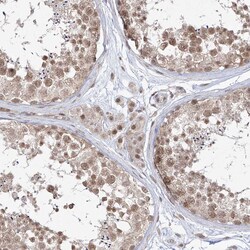 Invitrogen SNRNP27 Polyclonal Antibody 100 &mu;L; Unconjugated:Antibodies,