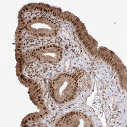 Invitrogen SNRNP27 Polyclonal Antibody 100 &mu;L; Unconjugated:Antibodies,
