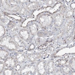 Invitrogen MAN1A2 Polyclonal Antibody 100 &mu;L; Unconjugated:Antibodies,
