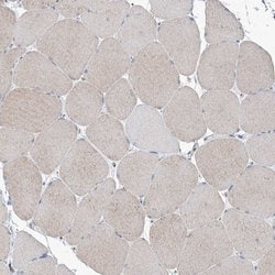 Invitrogen MAN1A2 Polyclonal Antibody 100 &mu;L; Unconjugated:Antibodies,