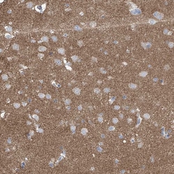 Invitrogen Synapsin 3 Polyclonal Antibody 100 &mu;L; Unconjugated:Antibodies,