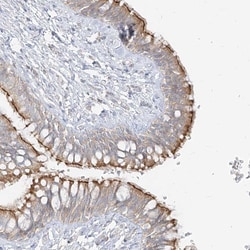 Invitrogen ZIM3 Polyclonal Antibody 100 &mu;L; Unconjugated:Antibodies,