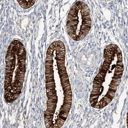 Invitrogen Mammaglobin B Polyclonal Antibody 100 &mu;L; Unconjugated:Antibodies,