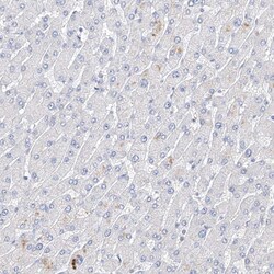Invitrogen Mammaglobin B Polyclonal Antibody 100 &mu;L; Unconjugated:Antibodies,