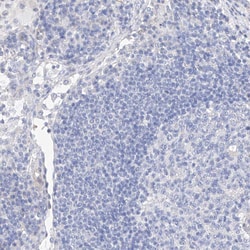 Invitrogen Mammaglobin B Polyclonal Antibody 100 &mu;L; Unconjugated:Antibodies,