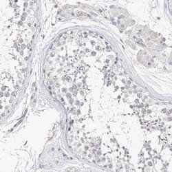 Invitrogen Mammaglobin B Polyclonal Antibody 100 &mu;L; Unconjugated:Antibodies,