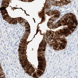 Invitrogen Mammaglobin B Polyclonal Antibody 100 &mu;L; Unconjugated:Antibodies,
