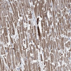 Invitrogen TMLHE Polyclonal Antibody 100 &mu;L; Unconjugated:Antibodies,