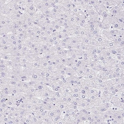 Invitrogen FATE1 Polyclonal Antibody 100 &mu;L | Buy Online | Invitrogen&trade; | Fisher Scientific