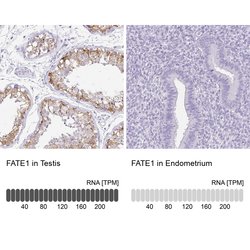 Invitrogen FATE1 Polyclonal Antibody 100 &mu;L | Buy Online | Invitrogen&trade; | Fisher Scientific