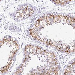 Invitrogen FATE1 Polyclonal Antibody 100 &mu;L | Buy Online | Invitrogen&trade; | Fisher Scientific