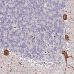 Invitrogen NCKAP5 Polyclonal Antibody 100 &mu;L; Unconjugated:Antibodies,