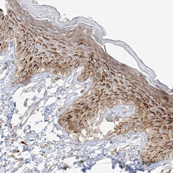 Invitrogen C2orf18 Polyclonal Antibody 100 μL; Unconjugated:Antibodies,