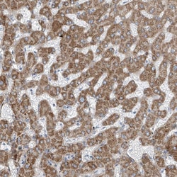 Invitrogen TENC1 Polyclonal Antibody 100 &mu;L; Unconjugated:Antibodies,