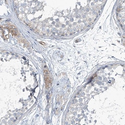 Invitrogen TENC1 Polyclonal Antibody 100 &mu;L; Unconjugated:Antibodies,