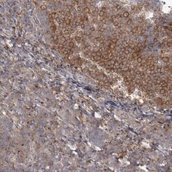 Cyclin G2 Rabbit anti-Human, Polyclonal, Invitrogen 100 &mu;L; Unconjugated:Antibodies,