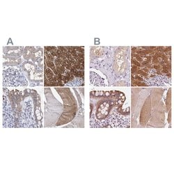 Invitrogen UGP2 Polyclonal Antibody 100 &mu;L; Unconjugated:Antibodies,