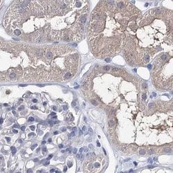 Invitrogen UGP2 Polyclonal Antibody 100 &mu;L; Unconjugated:Antibodies,