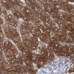 Invitrogen UGP2 Polyclonal Antibody 100 &mu;L; Unconjugated:Antibodies,