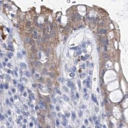 Invitrogen UGP2 Polyclonal Antibody 100 &mu;L; Unconjugated:Antibodies,
