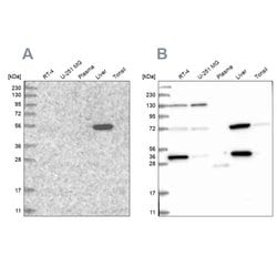 Invitrogen UGP2 Polyclonal Antibody 100 &mu;L; Unconjugated:Antibodies,